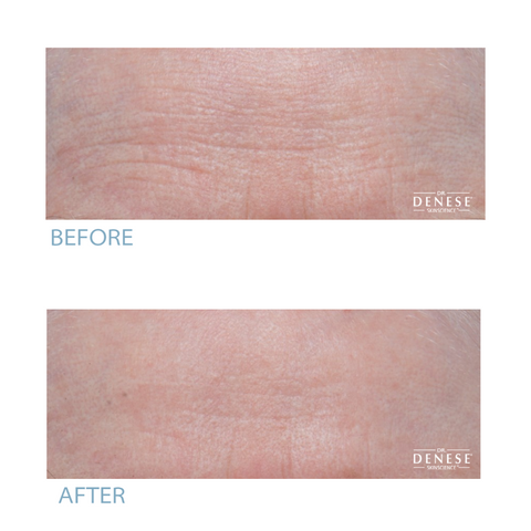 Dr. Denese HydroShield Pro Strength Night Serum 2oz